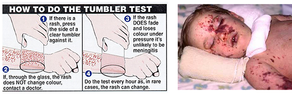 Tumbler test